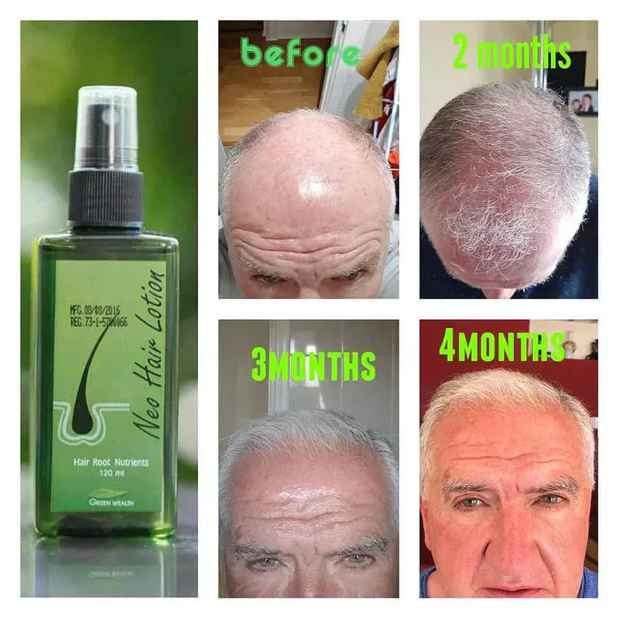 Neo Hair Lotion 120 ml - Zabcart