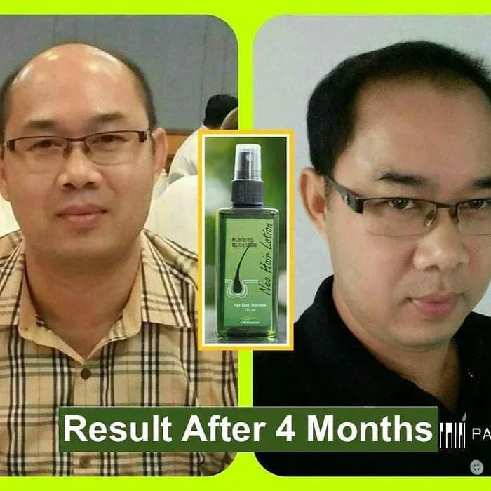 Neo Hair Lotion 120 ml - Zabcart