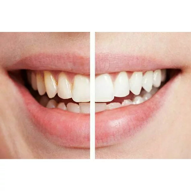 360° Spin Smile - Zabcart