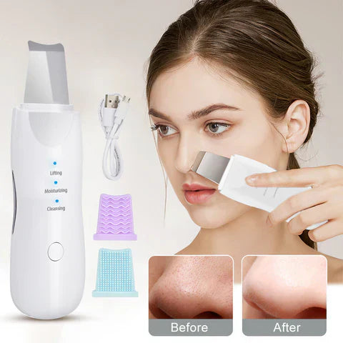 Facial Cleansing Shovel Skin Blackhead - Zabcart