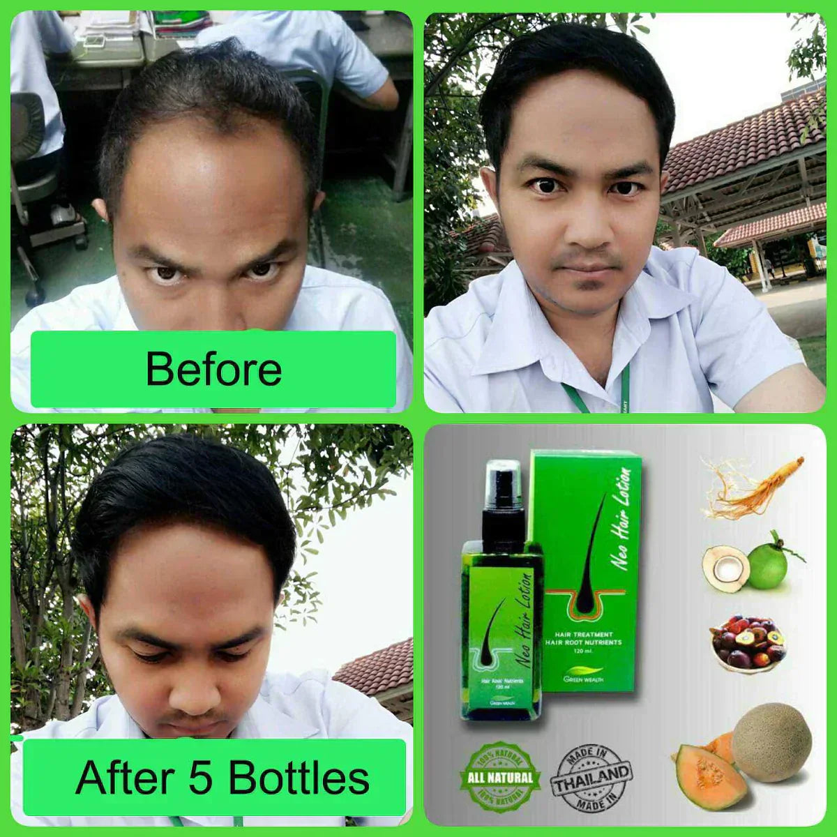 Neo Hair Lotion 120 ml - Zabcart