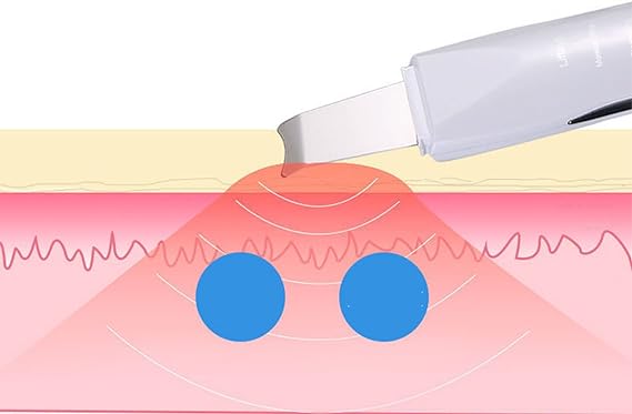 Face Blackhead Remover - Zabcart