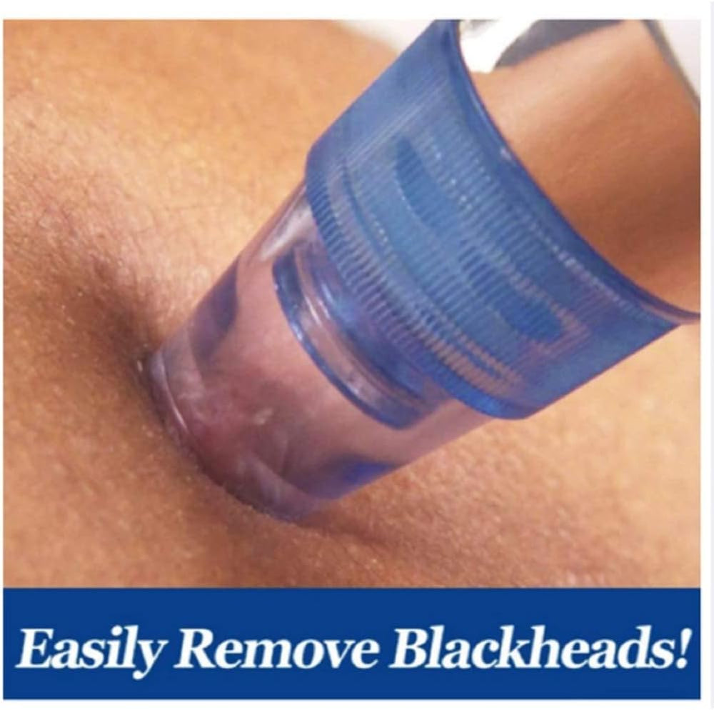 Pore Cleaning Device - Zabcart