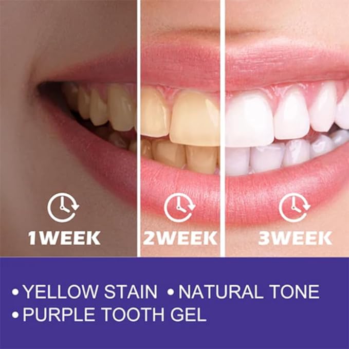Purple Whitening Toothpaste - Zabcart