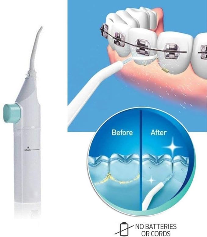 Dental Water Flosser - Zabcart