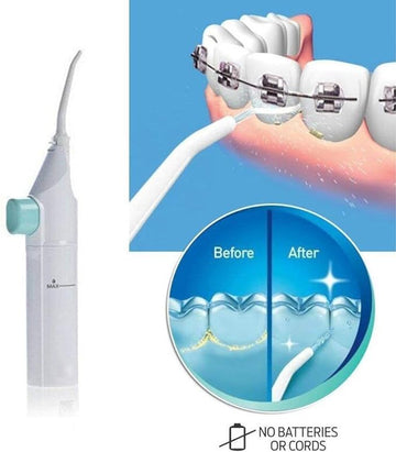 Dental Water Flosser - Zabcart