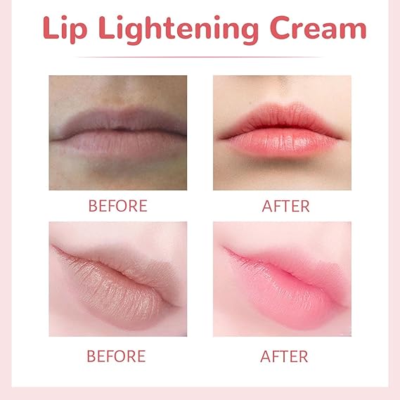 Lips Bleaching Cream Balm - Zabcart