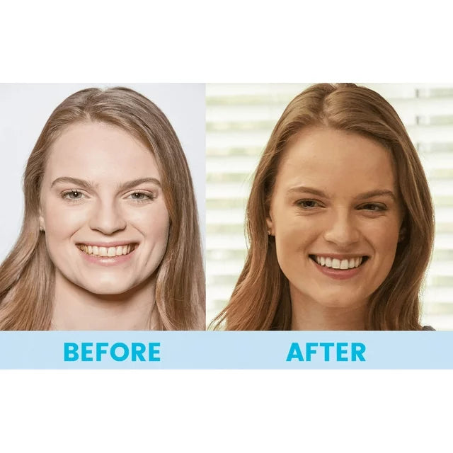 360° Spin Smile - Zabcart