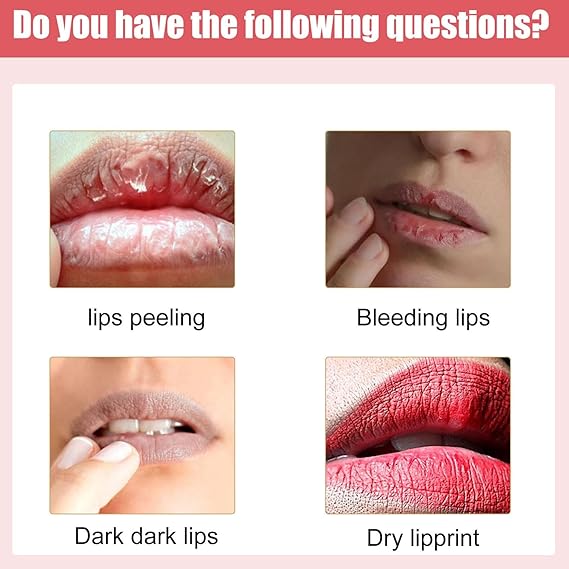Lips Bleaching Cream Balm - Zabcart