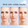 Neck Face Beauty Device - Zabcart