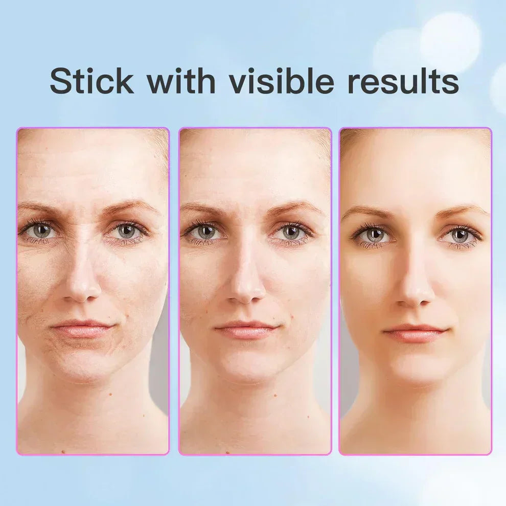 Neck Face Beauty Device - Zabcart