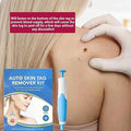 Acrochordon Skin Remover Kit - Zabcart