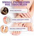 Nail Fungus Spray - Zabcart