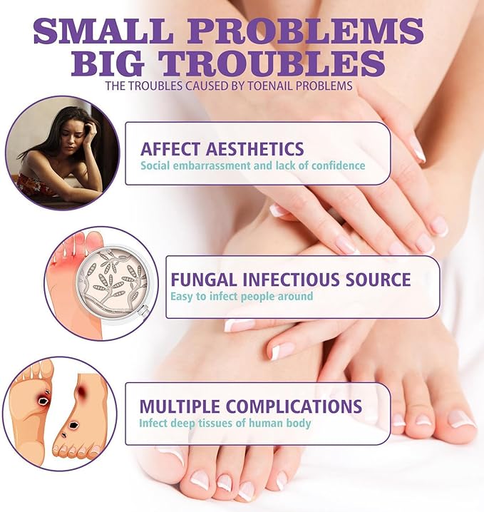 Nail Fungus Spray - Zabcart