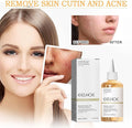 Toner for Face Skin - Zabcart