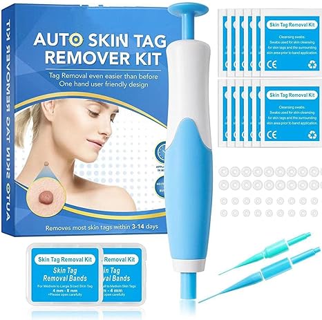Acrochordon Skin Remover Kit - Zabcart