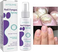 Nail Fungus Spray - Zabcart