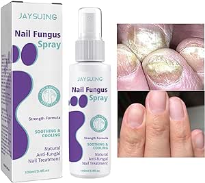 Nail Fungus Spray - Zabcart