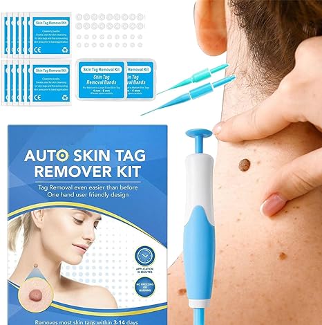 Acrochordon Skin Remover Kit - Zabcart