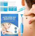 Acrochordon Skin Remover Kit - Zabcart