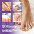 Nail Fungus Spray - Zabcart