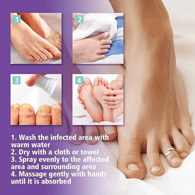 Nail Fungus Spray - Zabcart