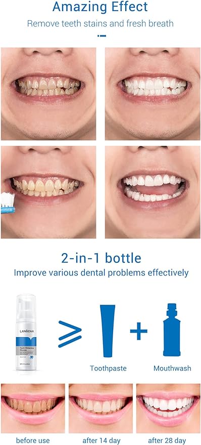 Teeth Whitening Mousse - Zabcart