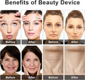 Eye Beauty Device - Zabcart