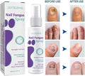 Nail Fungus Spray - Zabcart