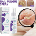 Nail Fungus Spray - Zabcart