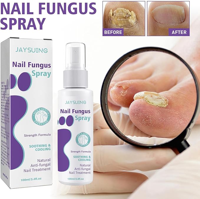 Nail Fungus Spray - Zabcart