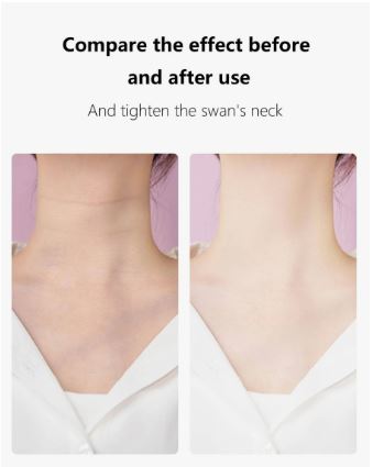 Anti Wrinkle Beauty Apparatus - Zabcart