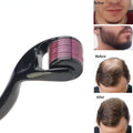Derma Roller System - Zabcart