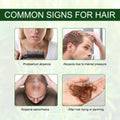 Rosemary Oil for Hair Growth - Zabcart